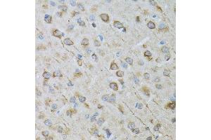 Immunohistochemistry of paraffin-embedded rat brain using CRYM antibody. (CRYM 抗体  (AA 1-314))