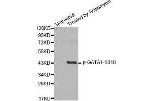 Western Blotting (WB) image for anti-GATA Binding Protein 1 (Globin Transcription Factor 1) (GATA1) (pSer310) antibody (ABIN1870204) (GATA1 抗体  (pSer310))