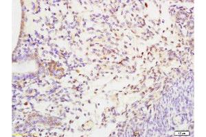 Formalin-fixed and paraffin embedded rat uterus tissue labeled with Anti-SHBG Polyclonal Antibody, Unconjugated at 1:200 followed by conjugation to the secondary antibody and DAB staining (SHBG 抗体  (AA 301-402))