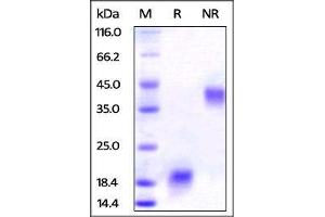 Human VEGF110 on SDS-PAGE under reducing (R) and no-reducing (NR) conditions. (VEGF110 (AA 27-136) (Active) 蛋白)