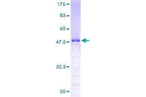 UBE2S Protein (AA 1-222) (GST tag)