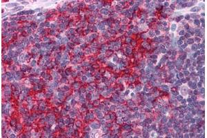 Human Thymus: Formalin-Fixed, Paraffin-Embedded (FFPE) (EFHD2 抗体  (N-Term))