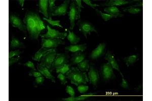 Immunofluorescence of monoclonal antibody to TSC22D1 on HeLa cell. (TSC22D1 抗体  (AA 1-144))