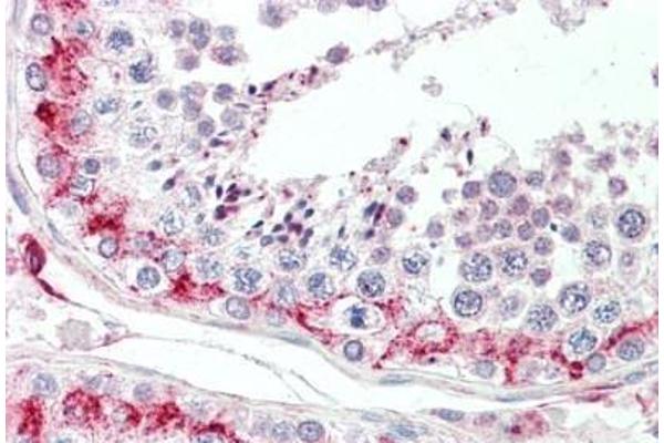 Lysozyme-Like 1 抗体  (N-Term)