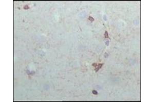 Immunohistochemistry (IHC) image for anti-Crystallin, alpha B (CRYAB) (AA 1-175) antibody (ABIN2464040)