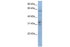 WB Suggested Anti-CENPB Antibody Titration: 0. (CENPB 抗体  (C-Term))