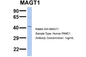 Host: Rabbit Target Name: MAGT1 Sample Type: PANC1 Antibody Dilution: 1. (MAGT1 抗体  (N-Term))