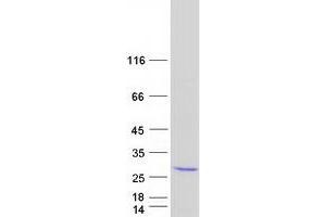 Western Blotting (WB) image for Dual Specificity Phosphatase 18 (DUSP18) protein (Myc-DYKDDDDK Tag) (ABIN2719831)