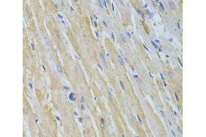 Immunohistochemistry of paraffin-embedded Rat heart using NME1 Polyclonal Antibody at dilution of 1:200 (40x lens). (NME1 抗体)