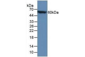 Detection of Recombinant CALB, Mouse using Polyclonal Antibody to Calbindin (CALB) (CALB1 抗体  (AA 3-261))