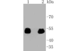 Lane 1: 293 lysates, Lane 2: F9 lysates probed with p53(S392) (3A1) Monoclonal Antibody  at 1:1000 overnight at 4˚C. (p53 抗体  (pSer392))