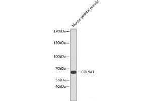 Western blot analysis of extracts of Mouse skeletal muscle using COL9A1 Polyclonal Antibody at dilution of 1:1000. (COL9A1 抗体)