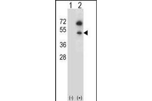 Western blot analysis of GNAS (arrow) using rabbit polyclonal GNAS Antibody (C-term) (ABIN656989 and ABIN2850497). (GNAS 抗体  (C-Term))