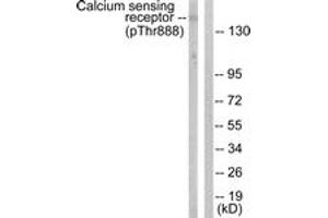Western blot analysis of extracts from LOVO cells, using Calcium Sensing Receptor (Phospho-Thr888) Antibody. (CASR 抗体  (pThr888))