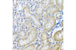 Immunohistochemistry of paraffin-embedded mouse kidney using HD antibody (ABIN3022456, ABIN3022457, ABIN3022458 and ABIN6218830) at dilution of 1:100 (40x lens). (HDAC6 抗体  (AA 1-200))