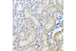 Immunohistochemistry of paraffin-embedded mouse kidney using HD antibody (ABIN3022456, ABIN3022457, ABIN3022458 and ABIN6218830) at dilution of 1:100 (40x lens). (HDAC6 抗体  (AA 1-200))