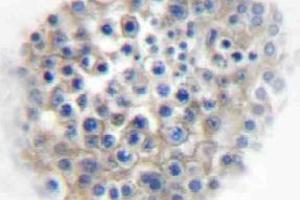 Immunohistochemistry (IHC) analyzes of AR alpha2A antibody in paraffin-embedded human testis tissue. (ADRA2A 抗体)
