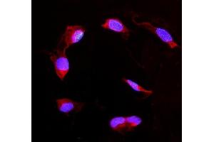 IF analysis of DDAH2 using anti-DDAH2 antibody (ABIN4886561).