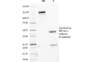 SDS-PAGE Analysis Purified Cytokeratin, HMW MAb (KRTH/1076). (Cytokeratin 2 抗体)