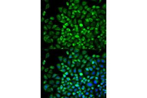 Immunofluorescence analysis of A549 cell using ANGPTL4 antibody. (ANGPTL4 抗体  (AA 26-406))