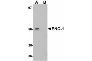 Image no. 1 for anti-Ectodermal-Neural Cortex 1 (With BTB-Like Domain) (ENC1) (Internal Region) antibody (ABIN478273) (ENC1 抗体  (Internal Region))