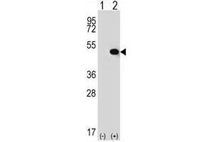 Western blot analysis of TRIP13 (arrow) using rabbit polyclonal TRIP13 Antibody (C-term) .