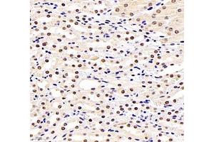 Immunohistochemistry (Paraffin-embedded Sections) (IHC (p)) image for anti-General Transcription Factor IIIC, Polypeptide 3, 102kDa (GTF3C3) antibody (ABIN7074039)