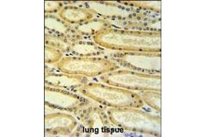 HSD17B11 Antibody (N-term) (ABIN653756 and ABIN2843056) IHC analysis in formalin fixed and paraffin embedded lung tissue followed by peroxidase conjugation of the secondary antibody and DAB staining. (HSD17B11 抗体  (N-Term))