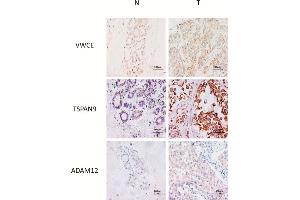 Immunohistochemistry (IHC) image for anti-ADAM Metallopeptidase Domain 12 (ADAM12) (AA 589-738) antibody (ABIN6136521)