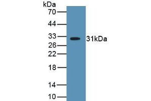 Detection of Recombinant MYH2, Human using Polyclonal Antibody to Myosin Heavy Chain 2 (MYH2) (MYH2 抗体  (AA 1237-1471))