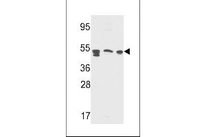 Western blot analysis in Y79,A2058,CEM cell line lysates(35ug/lane) (APCS 抗体  (AA 285-314))