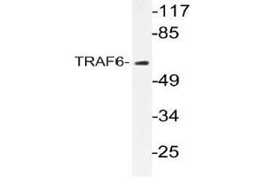 Western blot (WB) analyzes of TRAF6 antibody in extracts from HeLa cells. (TRAF6 抗体)