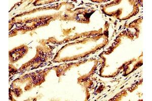 IHC image of ABIN7154533 diluted at 1:200 and staining in paraffin-embedded human prostate tissue performed on a Leica BondTM system. (GDF1 抗体  (AA 369-478))