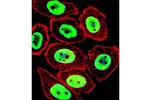 Immunofluorescence (IF) image for anti-Ewing Sarcoma Breakpoint Region 1 (EWSR1) antibody (ABIN3003929) (EWSR1 抗体)