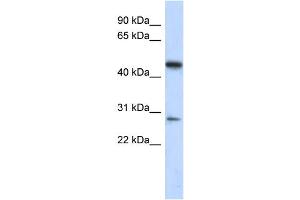 WB Suggested Anti-C13orf31 Antibody Titration: 0. (LACC1 抗体  (Middle Region))