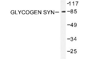 Image no. 1 for anti-Glycogen Synthase (GYS) antibody (ABIN265444) (Glycogen Synthase 抗体)