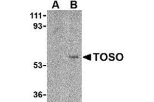 Western blot analysis of Toso in human lung tissue lysate with this product at 1 μg/ml in either the (A) presence, or (B) absence of blocking peptide. (FAIM3 抗体  (C-Term))
