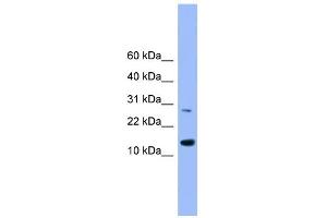 WB Suggested Anti-GLRX2 Antibody Titration: 0. (Glutaredoxin 2 抗体  (Middle Region))