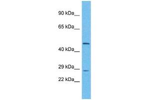 Host: Rabbit Target Name: UTP11L Sample Type: Hela Whole Cell lysates Antibody Dilution: 1. (UTP11L 抗体  (N-Term))