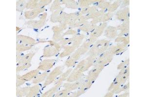 Immunohistochemistry of paraffin-embedded Rat heart using PLEK Polyclonal Antibody at dilution of 1:200 (40x lens). (Pleckstrin 抗体)