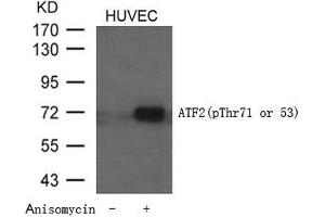 Western blot analysis of extracts from HUVEC cells untreated or treated with Anisomycin using ATF2 (Phospho-Thr71 or 53) Antibody. (ATF2 抗体  (pThr71))