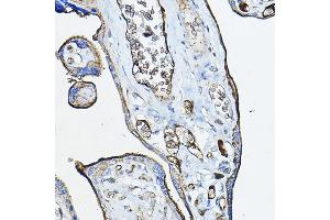 Immunohistochemistry of paraffin-embedded human placenta using CHRN Rabbit pAb (ABIN6133256, ABIN6138583, ABIN6138584 and ABIN6218660) at dilution of 1:100 (40x lens). (CHRNA7 抗体  (AA 23-230))