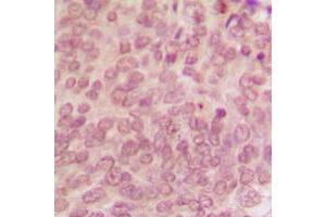 Immunohistochemistry (IHC) image for anti-Tumor Protein P53 (TP53) (C-Term), (pSer315) antibody (ABIN7297186)