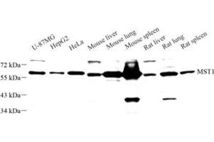 Western blot analysis of MST1 (ABIN7075561) at dilution of 1: 1000 (STK4 抗体)