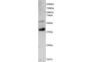 Image no. 1 for anti-Protein Phosphatase 2, Regulatory Subunit B', epsilon Isoform (PPP2R5E) (C-Term) antibody (ABIN374131) (PPP2R5E 抗体  (C-Term))