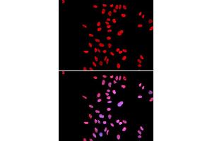 Immunofluorescence analysis of U2OS cells using DKC1 antibody (ABIN5970956). (DKC1 抗体)
