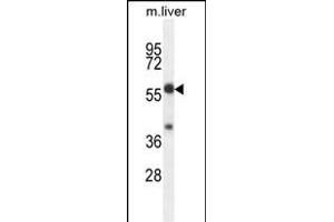 TBCCD1 Antibody (C-term) (ABIN654531 and ABIN2844250) western blot analysis in mouse liver tissue lysates (35 μg/lane).