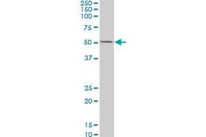 CSNK1G2 monoclonal antibody (M02), clone 2E6. (Casein Kinase 1 gamma 2 抗体  (AA 1-415))