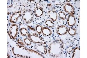 Immunohistochemical staining of paraffin-embedded Kidney tissue using anti-BTK mouse monoclonal antibody. (BTK 抗体)