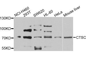 Western blot analysis of extracts of various cell lines, using CTSC antibody (ABIN5974676) at 1/1000 dilution. (CTSC 抗体)